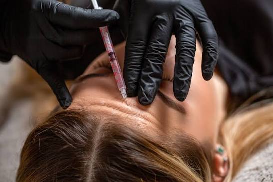 Botox Treatment