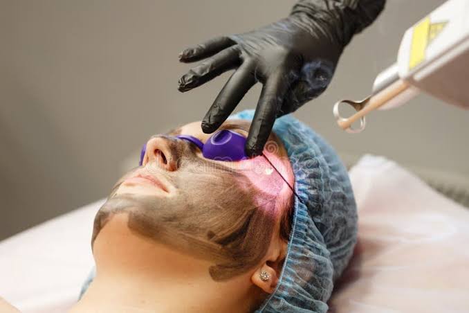 4-Step Laser Facial